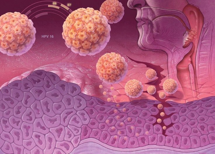 HPV iekļūšana cilvēka ķermenī