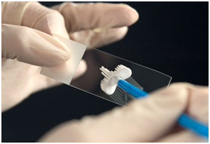 Pap tests uz cilvēka papilomas vīruss infekciju
